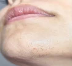 If You’re a Woman With Chin Whiskers, Pay Attention — Here’s What It May Mean